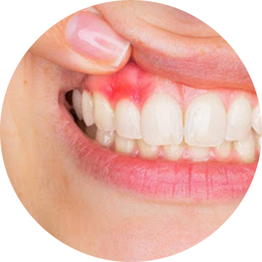 periodoncia lilident